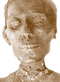 múmia diabétesz kezelésére kapacitás cukorbetegség kínában